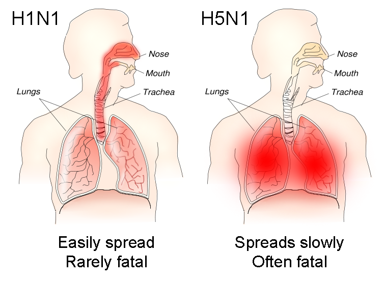 H1N1_versus_H5N1_pathology